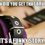How Did You Get That Bruise?